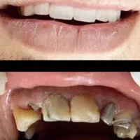 خدمات دندانپزشکی|خدمات آرایشگری و زیبایی|یاسوج, |دیوار
