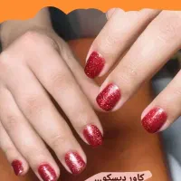 کاشت رایگان هدیه