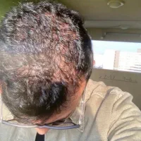 مثل ماکارانی ضخیم میشه