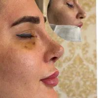 عمل بینی با چک صیادی مشاوره رایگان فوقتخصص ENT|خدمات زیبایی و سلامت|تهران, سهروردی|دیوار
