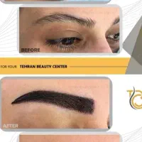 تور جراحی زیبایی بانوان|خدمات آرایشگری و زیبایی|ساری, |دیوار