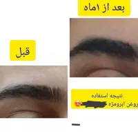 زیبایی