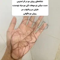 دفتر پخش تونیک هیرفرند بیز (اصلی) ضدریزش و رویش مو|آرایشی، بهداشتی، درمانی|مشهد, توس (بلوار توس)|دیوار