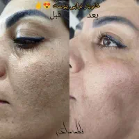 فیبروز میکرو شیدینگ لب بن مژه خط چشم ریموو|خدمات آرایشگری و زیبایی|بندرعباس, |دیوار