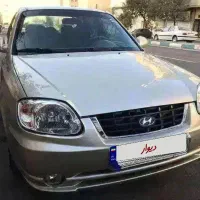 ورنا مدل ۸۴