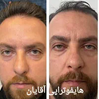جشنواره تخفیفات کلینیک پوست همراه با هدیه|خدمات آرایشگری و زیبایی|مشهد, کوه سنگی|دیوار