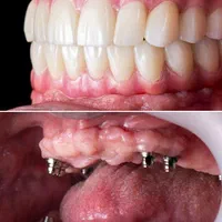 جشنواره  ویژه ایمپلنت تخصصی و دیجیتال|پزشکی|شیراز, فرهنگ شهر|دیوار