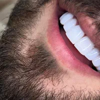 خدمات دندانسازی و دندانپزشکی با تعرفه ویژه|خدمات آرایشگری و زیبایی|شیراز, هفت تنان|دیوار