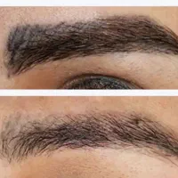 تخفیف ریمو ابرو برای ۱۰ نفر اول