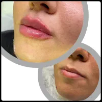 مرکز لیزر فرمدبابیش از 2هزار رضایت مشتری/مسکن|خدمات آرایشگری و زیبایی|کرمانشاه, |دیوار