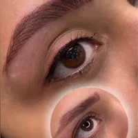 مدل میکروبلیدینگ