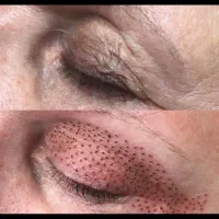 زیبایی پوست و مو تخفیف ویژه