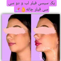 آموزش  و ارائه  ژل و بوتاکس و مزو|خدمات آموزشی|شیراز, سینما سعدی|دیوار