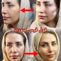 انجام تمامی خدمات زیبایی توسط پزشک زیبایی|خدمات آرایشگری و زیبایی|قم, باغ شازده|دیوار