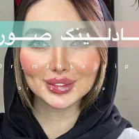 فیلر بینی ژل لب تکنیک M تخصصی تزریق فول فیس نچرال|خدمات زیبایی و سلامت|تهران, الهیه|دیوار