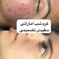 کرم وایتکس اصل