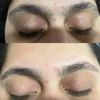 اصلاح کامل صورت وابرو