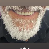 ساخت دندان مصنوعی کامل / تکه ای / تکی|پزشکی|شیراز, شهرک پرواز|دیوار