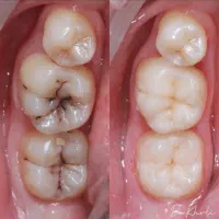 تخفیف خدمات دندانپزشکی و شرایط پرداخت اقساط|خدمات آرایشگری و زیبایی|رشت, گلسار|دیوار