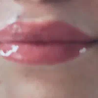 مدل۵۰ درصد تخفیف ویژه میکرو  بلدینگ فیبروز