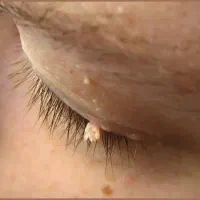 مشاوره تخصصی ویروسهای خاص بدن (مشاوره محرمانه)|آرایشی، بهداشتی، درمانی|گنبد کاووس, |دیوار