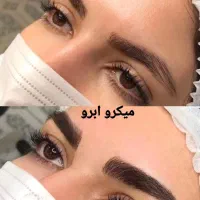انجام خدمات میکرو فیبروز شیدینگ لب خط چشم