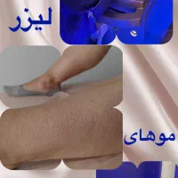 کربن تراپی،لیزر و فیشال vip