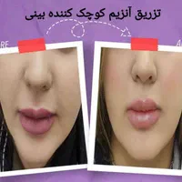 خدمات زیبایی جامع با بهترین کیفیت|خدمات آرایشگری و زیبایی|اصفهان, شاهزاده ابراهیم|دیوار