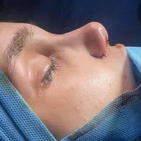 پی ارپی بوتاکس چانه هایفوفیلر لب چانه گونه لیفت نخ|خدمات آرایشگری و زیبایی|مشهد, هنرستان|دیوار