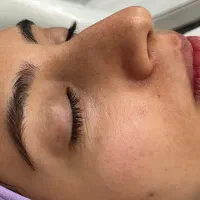 فیشال تخصصی و درمانی پوست با بهترین متریال