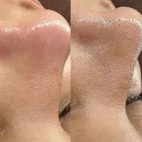 پاکسازی تخصصی و فیشال vip