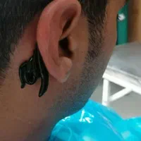 کلینیک لیزر کرایو زگیل خال میخچه حجامت زالو بوتاکس|خدمات آرایشگری و زیبایی|شیراز, حافظیه|دیوار