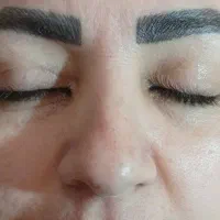 فیشال تخصصی  پوست فقط ۳۵۰تومان .