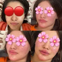 ژل بوتاکس پیرسینگ مزوژل آنزیم آموزش|خدمات آرایشگری و زیبایی|اسلام‌‌آباد غرب, |دیوار