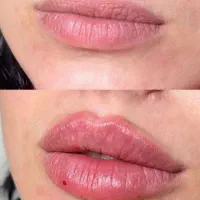 جشنواره بهاری کلینیک زیبایی و مراقبت پوستی سپیدار