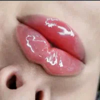 ژل و بوتاکس|خدمات آرایشگری و زیبایی|چناران, |دیوار