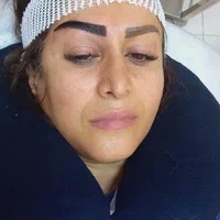 کاشت دائمی ابرو رشت|خدمات آرایشگری و زیبایی|رشت, گلسار|دیوار