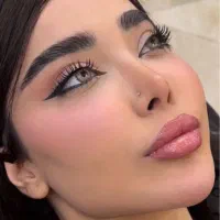 تخفیفات ویژه ژل و بوتاکس