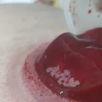 حجامت بادکش.طب سنتی برداشت خال وبا پزشک|خدمات آرایشگری و زیبایی|شیراز, دشت چنار|دیوار