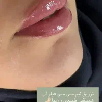 تخصص در بوتاکس و فیلر و جوانسازی|خدمات آرایشگری و زیبایی|شیراز, بعثت|دیوار