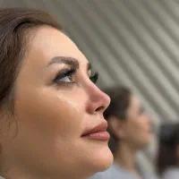 جشنواره جراحی بینی لیفت سینه صورت شکم اسلیو وبایپس|خدمات زیبایی و سلامت|تهران, میدان ولیعصر|دیوار