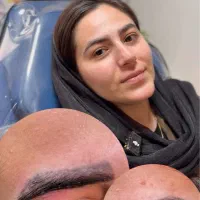 پاک کردن تاتو با لیزر در کرمان