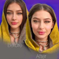 کلینیک زیبایی اقساط ژل فیلربادی نخ بوتاکس لاغری