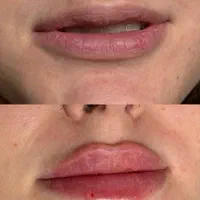 کلینیک تزریق ژل و بوتاکس و آنزیم پزشک|خدمات آرایشگری و زیبایی|کرج, باغستان|دیوار