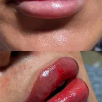 شیدینگ لب روسی