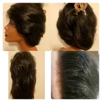 پروتز مو وارداتی زنانه و مردانه