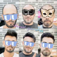 پروتز مو  / نصب فوری / کاملا طبیعی با ضمانت کیفیت