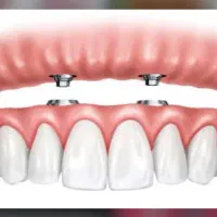 کار آموز لابراتوار دندانسازی