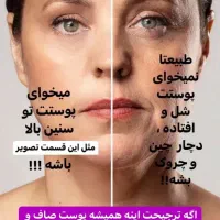 کرم لیفتینگ|آرایشی، بهداشتی، درمانی|مشگین شهر, |دیوار