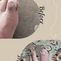 دیابت|خدمات آرایشگری و زیبایی|تهران, امام زاده عبدالله|دیوار